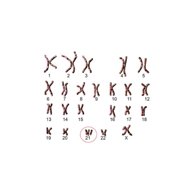 karyotyping-tile (1)
