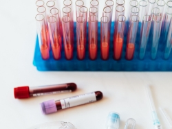 ige-igg-testing