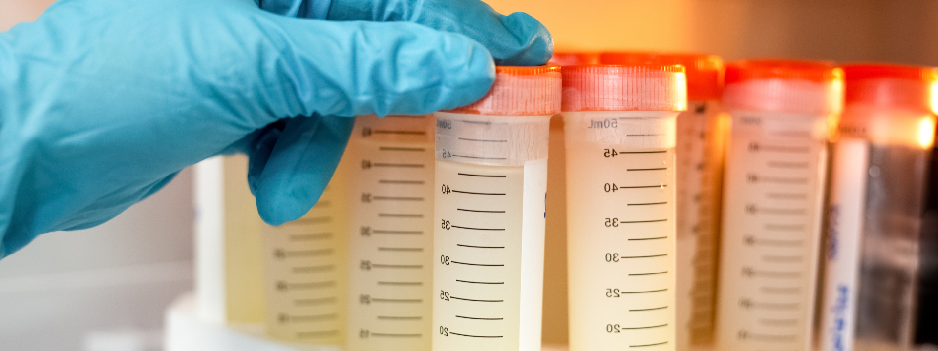 bannière-cyroconservation