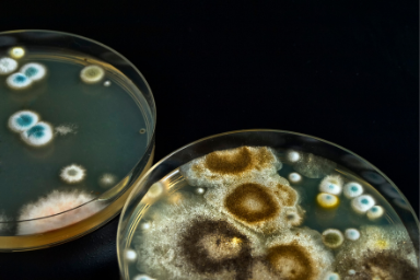 listeria-monocytogenes