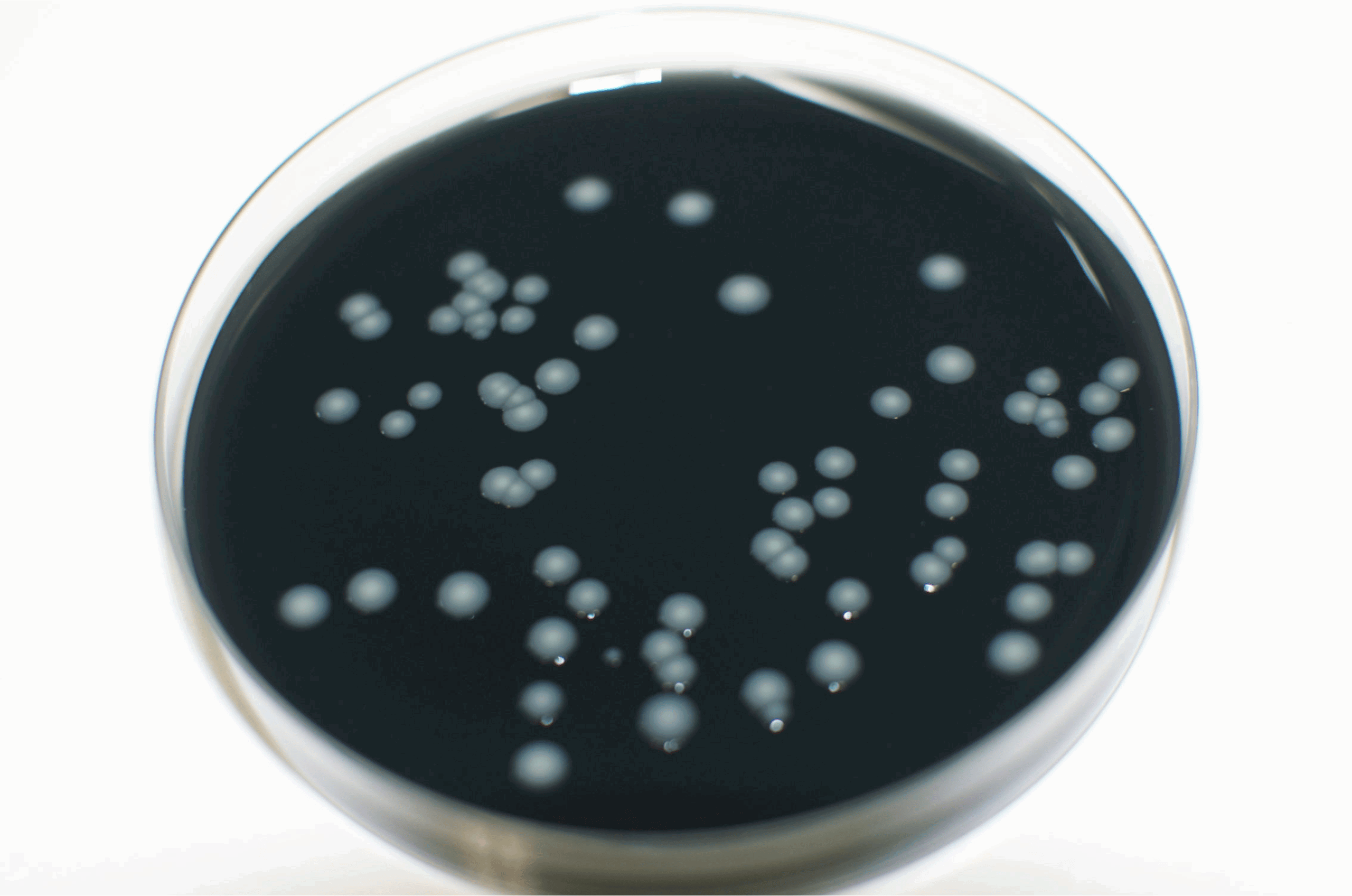 legionella