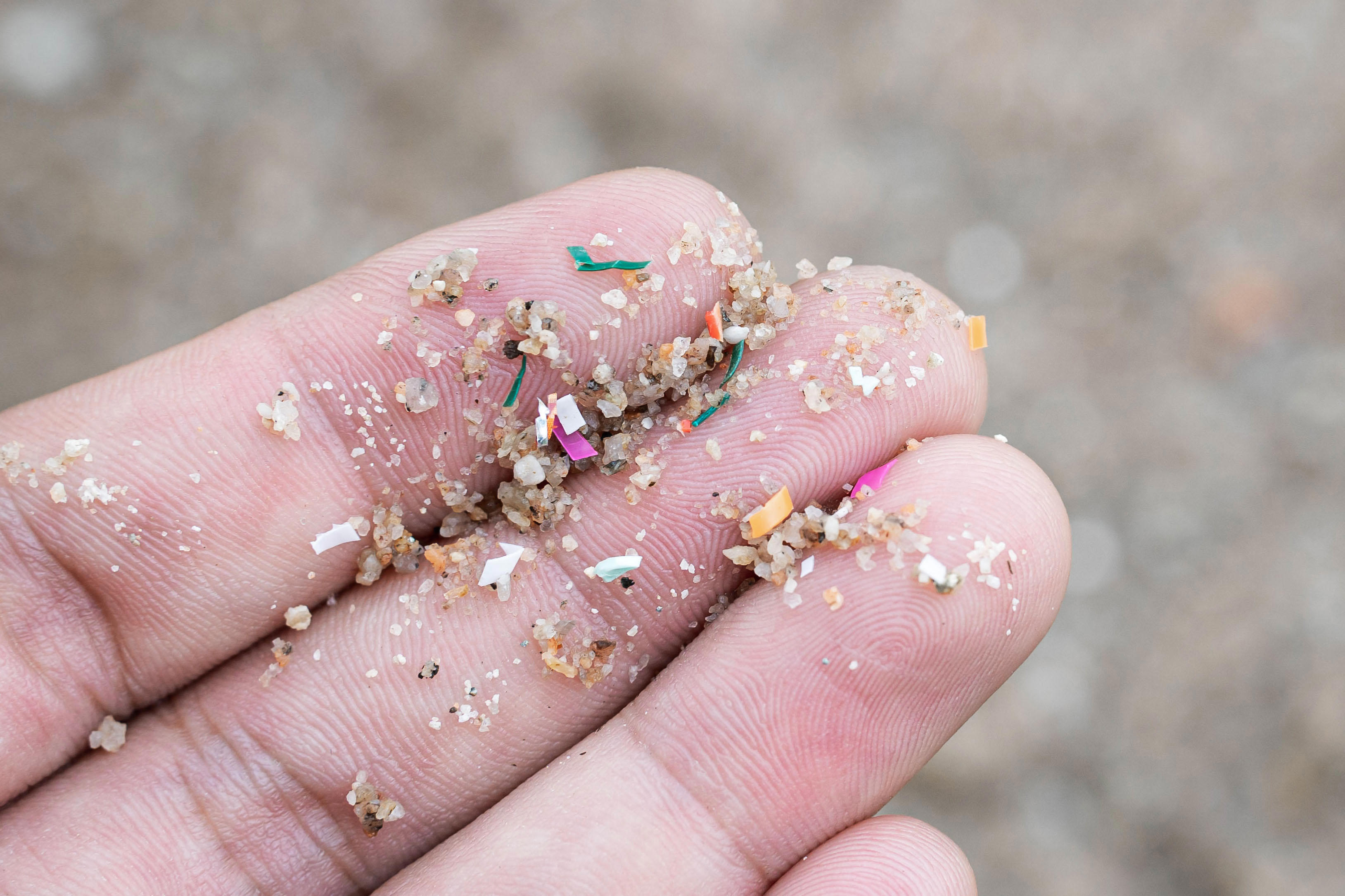 close-up-shot-of-microplastics-placed-on-a-person-2026-03-24-15-28-48-utc