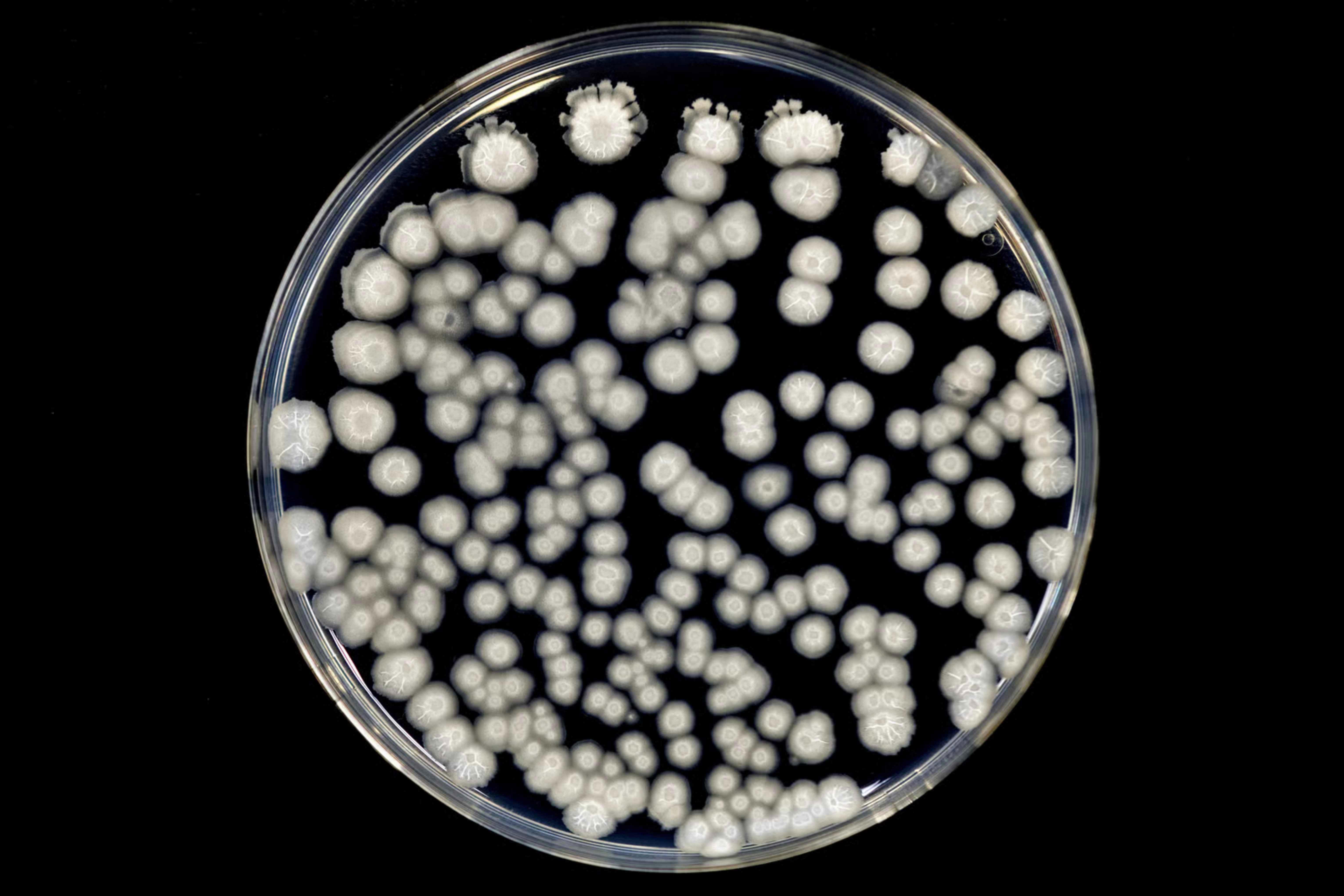 alcance-legionella