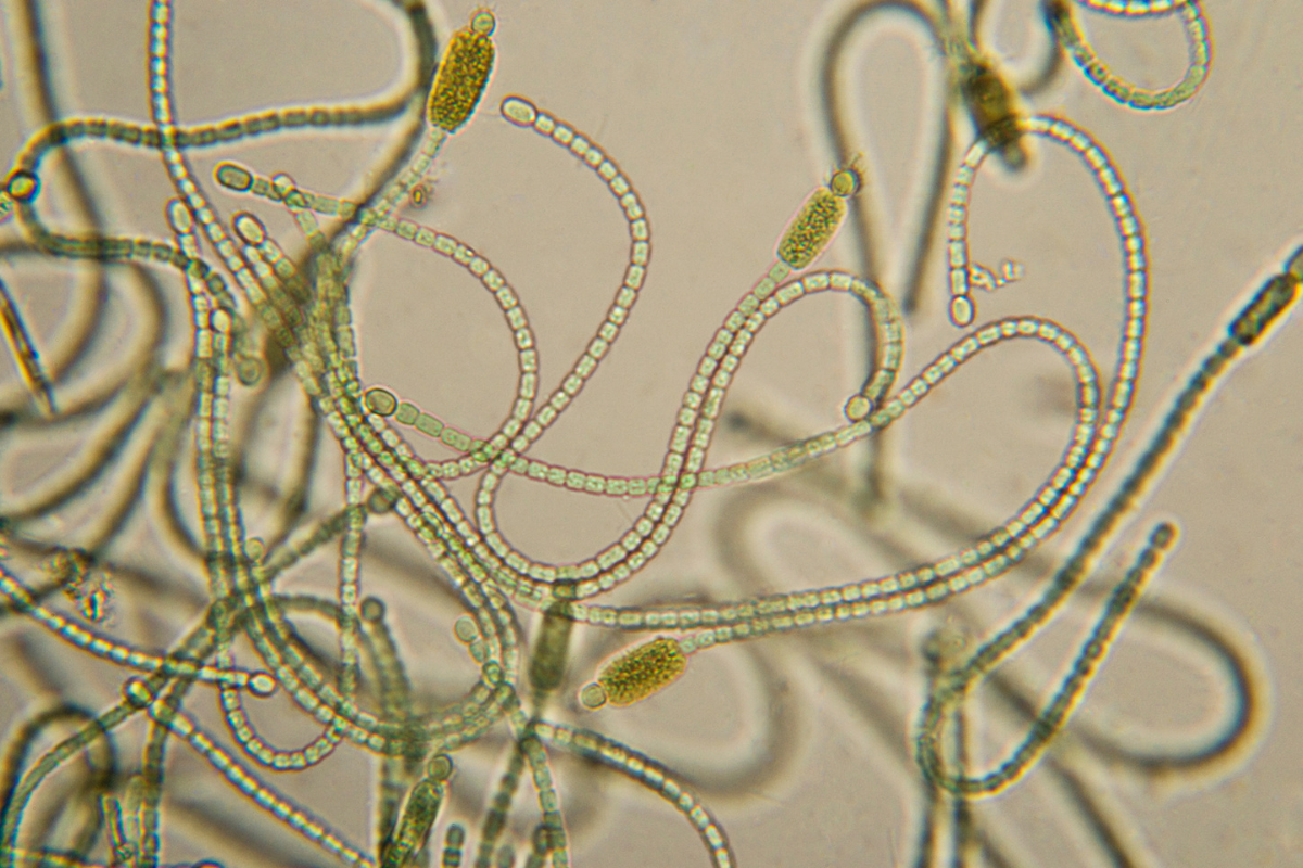 cianobacterias (1)