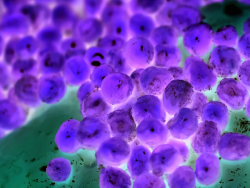 enterococci-testing-accordion-tile