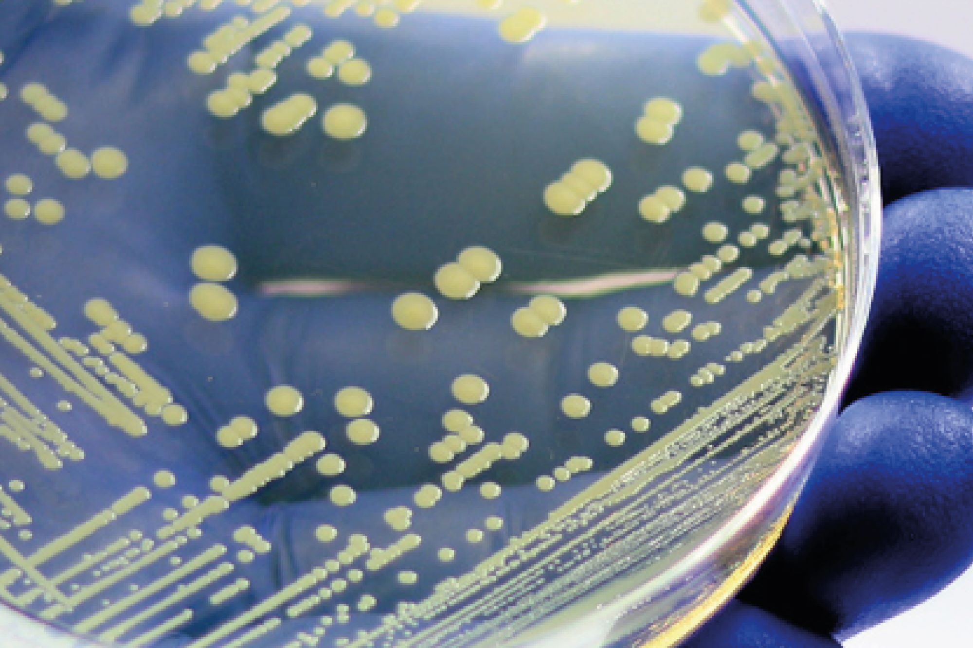 efficacite microbiologique