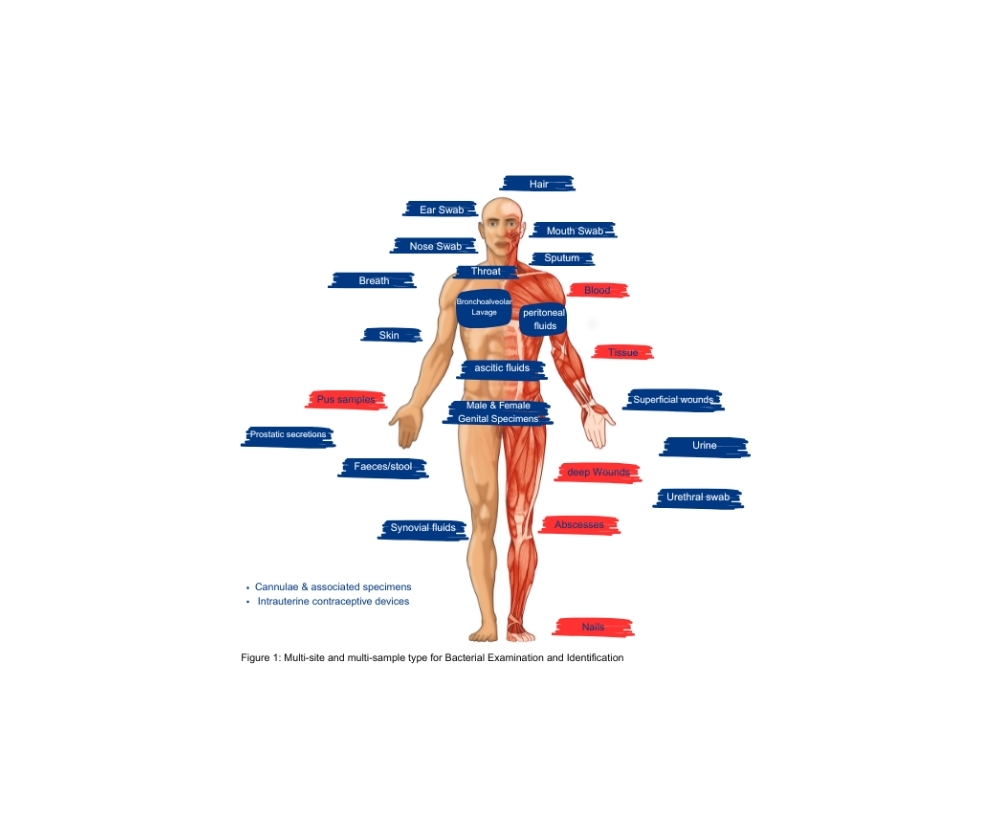 body-sites-tile