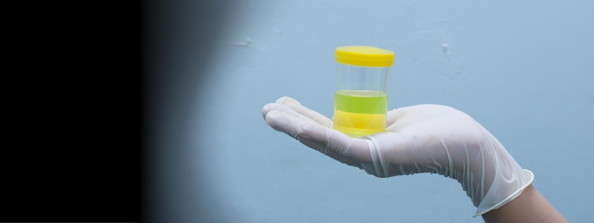 alcohol-urine-test