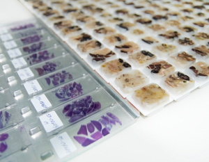 histopathology-tile-2