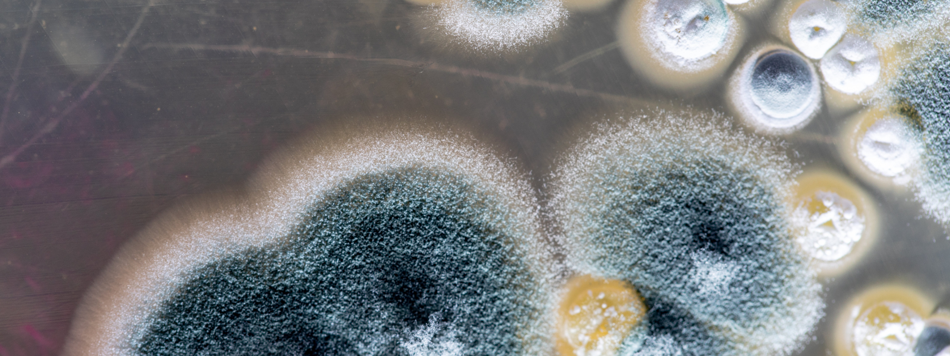 yeast-and-mould-testing-banner
