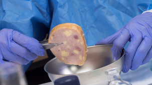 listeria