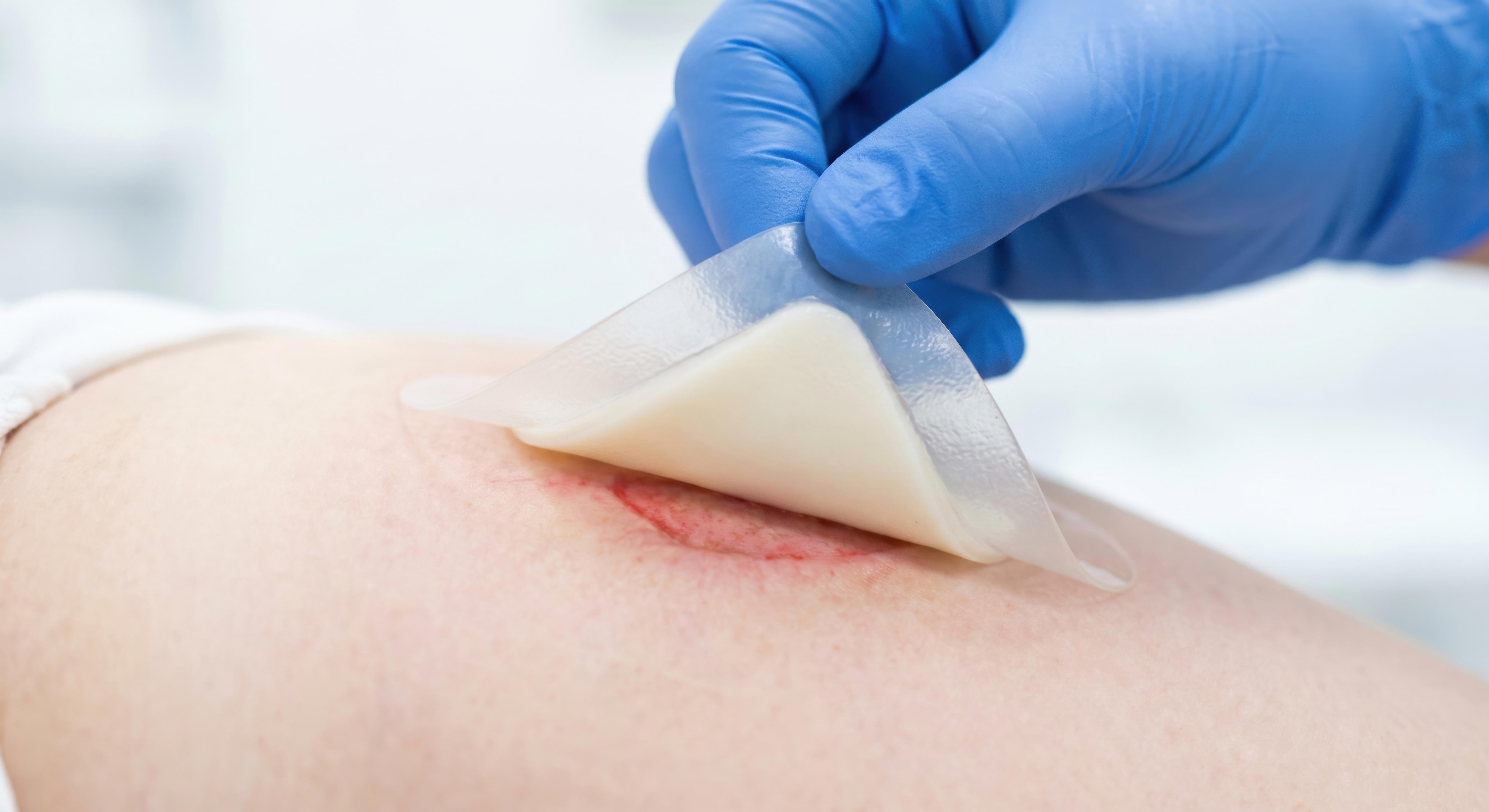 wound-care-wound