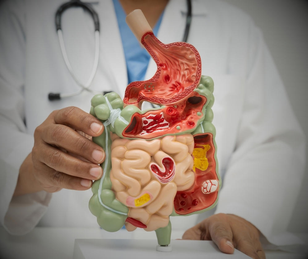 gut-diagram