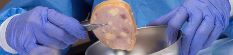actu-listeria