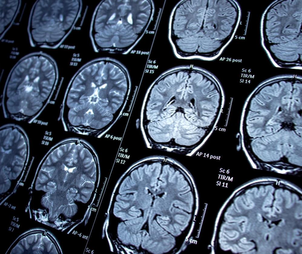 rare-diseases-tile (1)