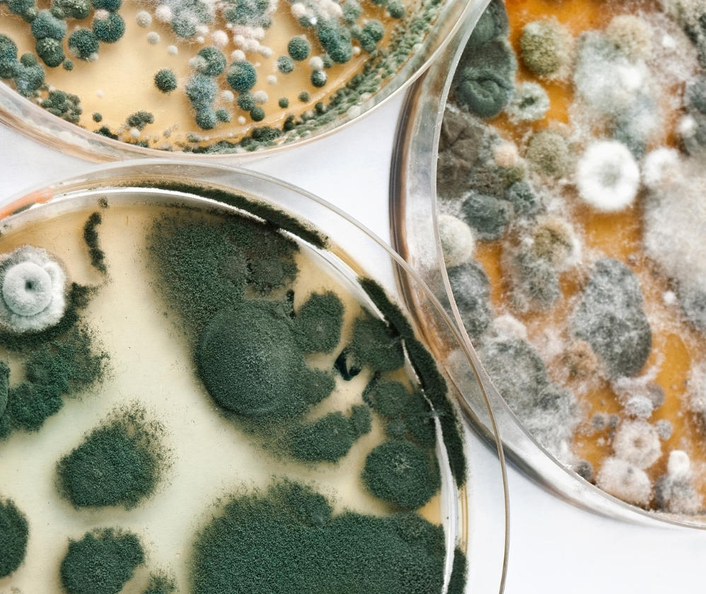 mycological-examination-tile