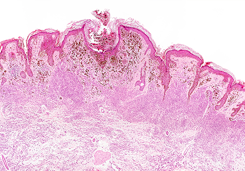 Coupe histologique colorée en rose et violet d’un tissu biologique, probablement cutané, montrant les différentes couches de l’épiderme et du derme avec des structures cellulaires distinctes. Cette image illustre les capacités d’analyse microscopique d’Eurofins BioPharma Product Testing dans le cadre d’études biologiques et médicales de haute précision.