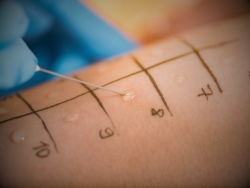 gold-standard-allergy-test