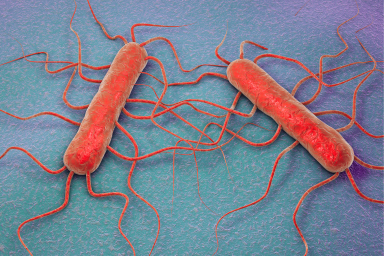 origine-de-la-contamination-de-listeria