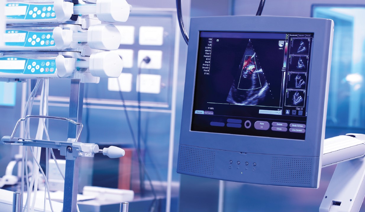 Écran médical affichant une échographie cardiaque en couleur, avec plusieurs images de coupes visibles sur le côté droit. À gauche, des pompes à perfusion sont montées sur un support métallique. L’ensemble est situé dans un environnement hospitalier ou de recherche clinique Eurofins BioPharma Product Testing, illustrant des équipements utilisés pour le suivi et l’analyse cardiovasculaire.