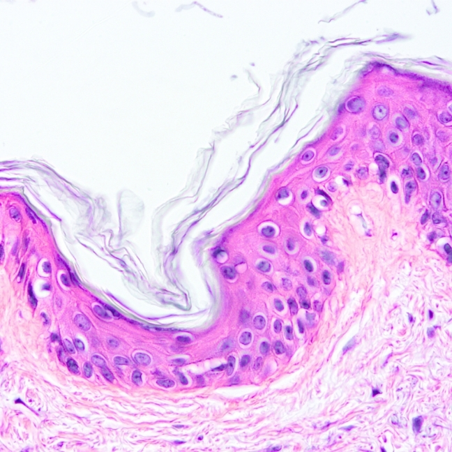 histology-tile