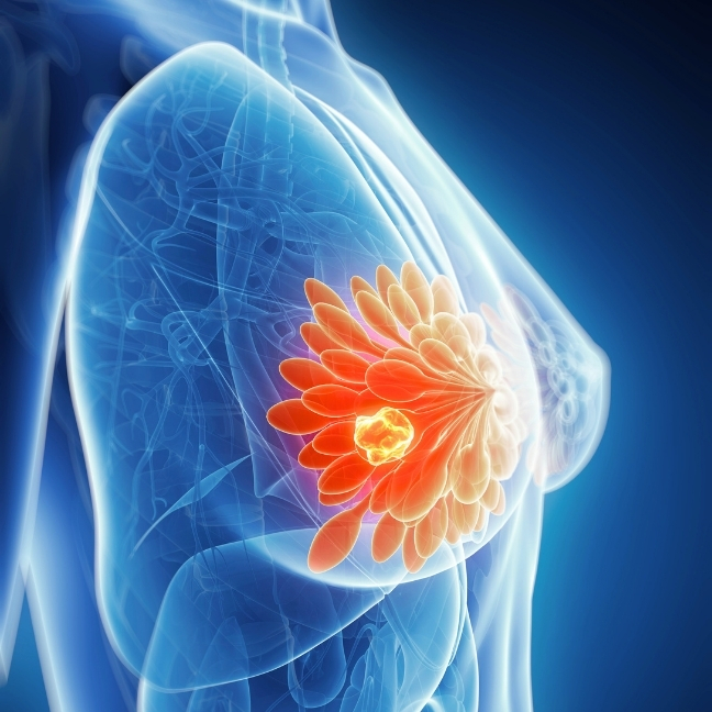 breast-tissue-tile