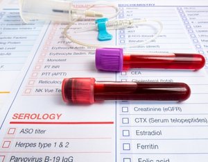 infectious-serology-tile