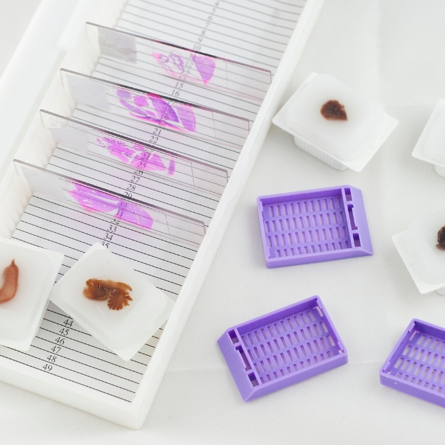 histopathology-tile