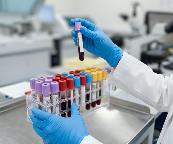 samples-in-the-lab