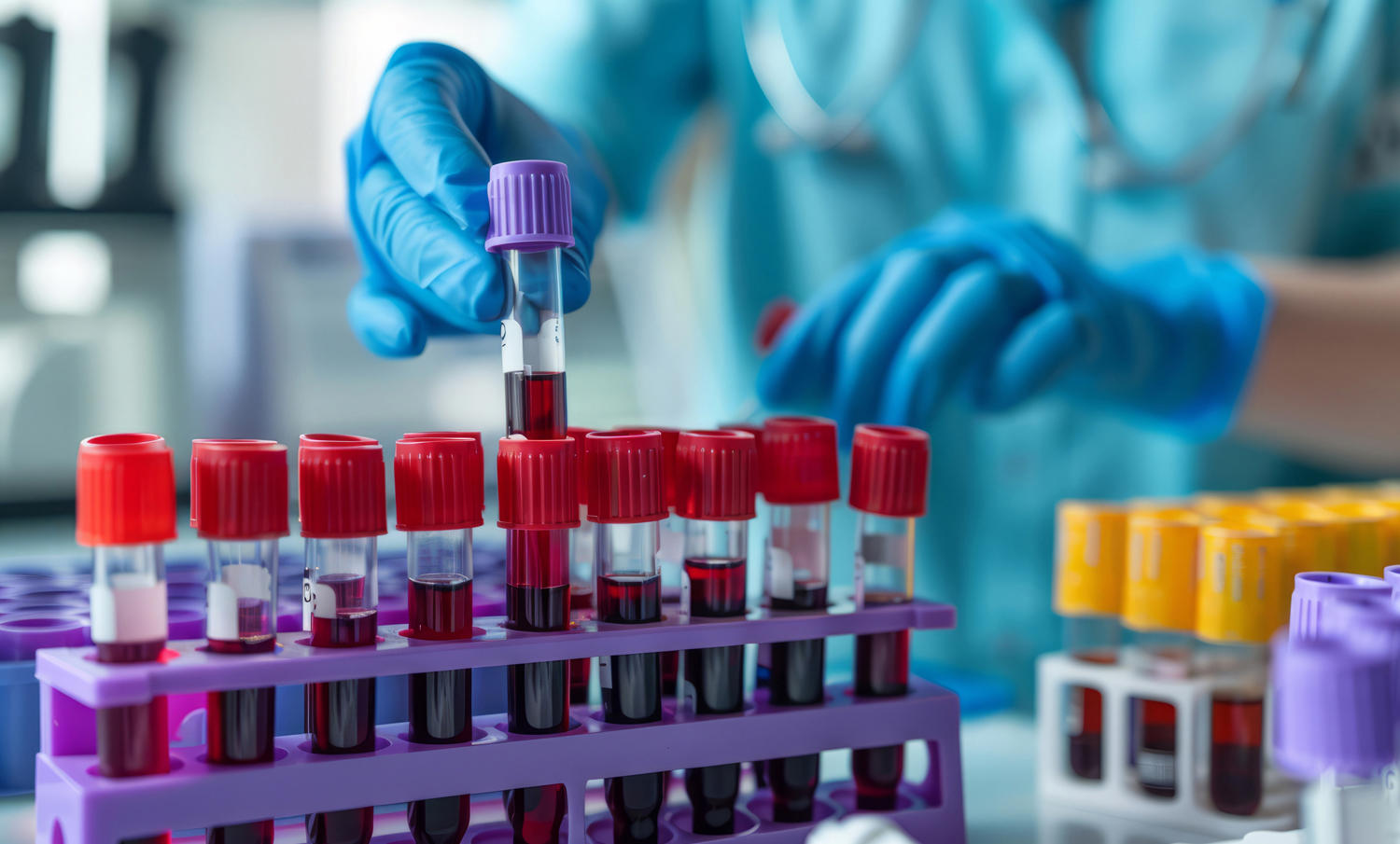 clinical laboratory specimen test tubes
