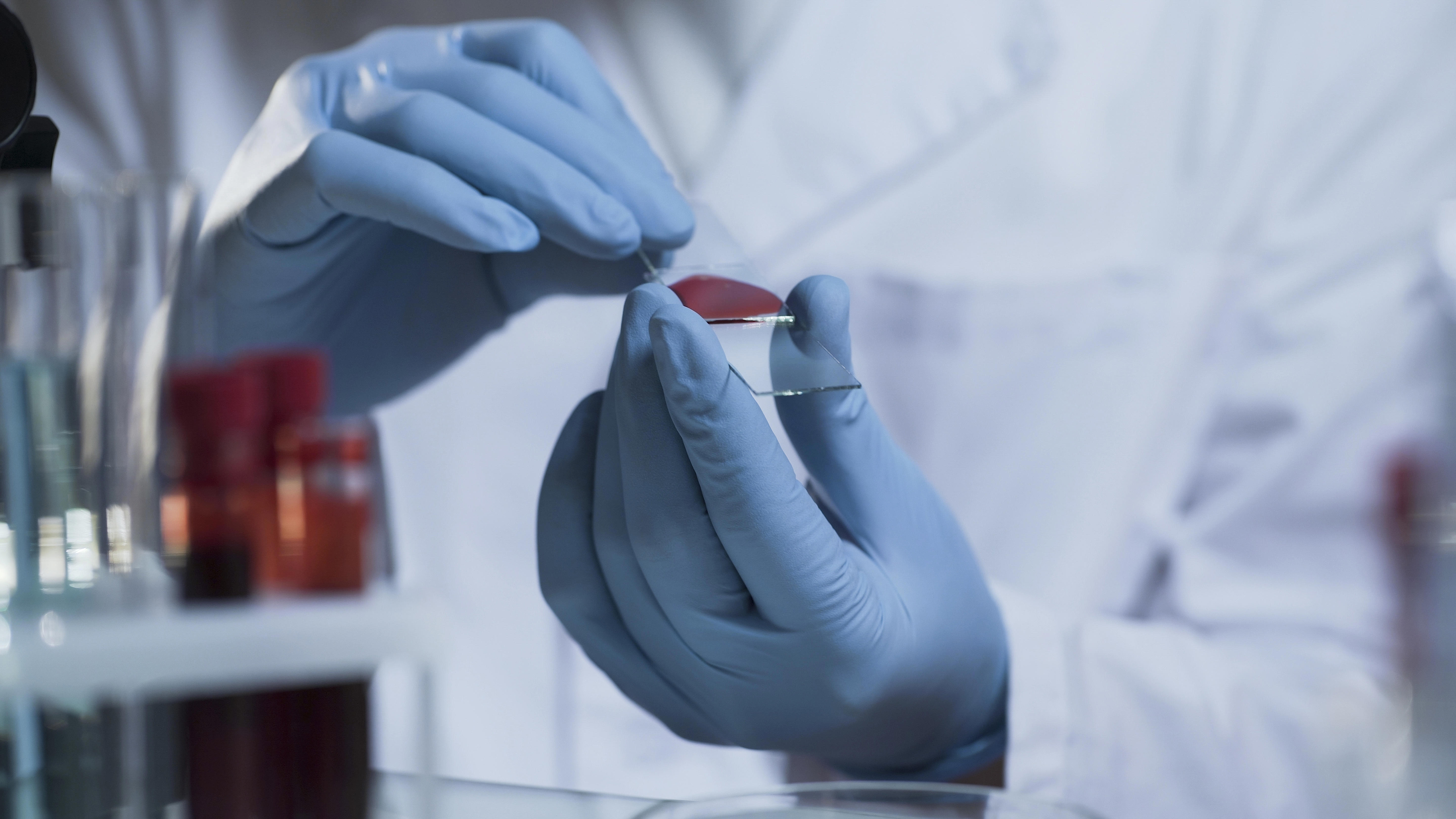medical-scientist-going-to-conduct-laboratory-research-on-blood-sample-clinic_1
