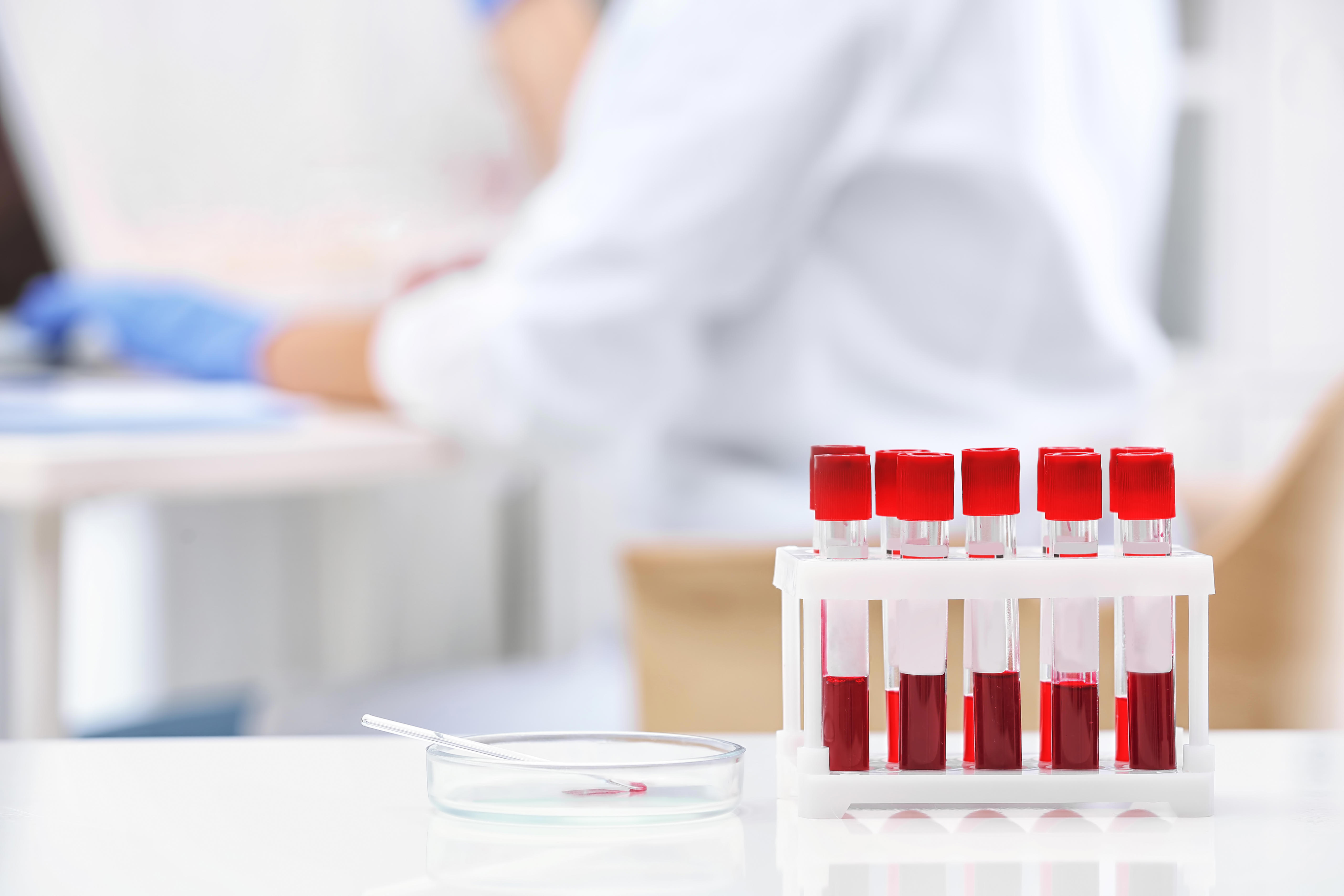 test-tubes-with-blood-samples-and-scientist-working-on-computer-in-laboratory-adobestock_217628076