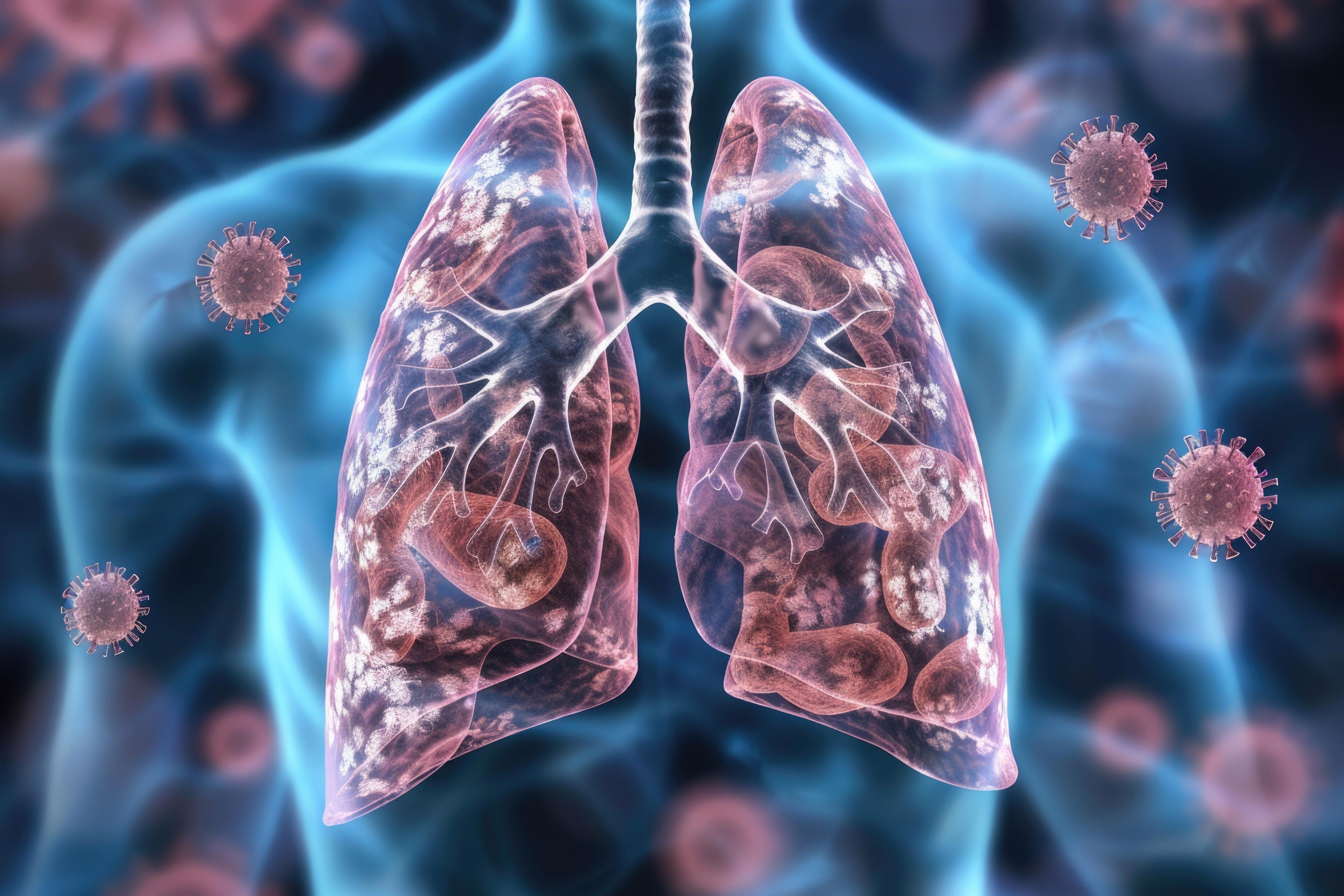 lung-with-virus-rsv-infection-long-covid-world-tuberculois-day-air-pollution-and-cancer-concept_adobestock_1002280937
