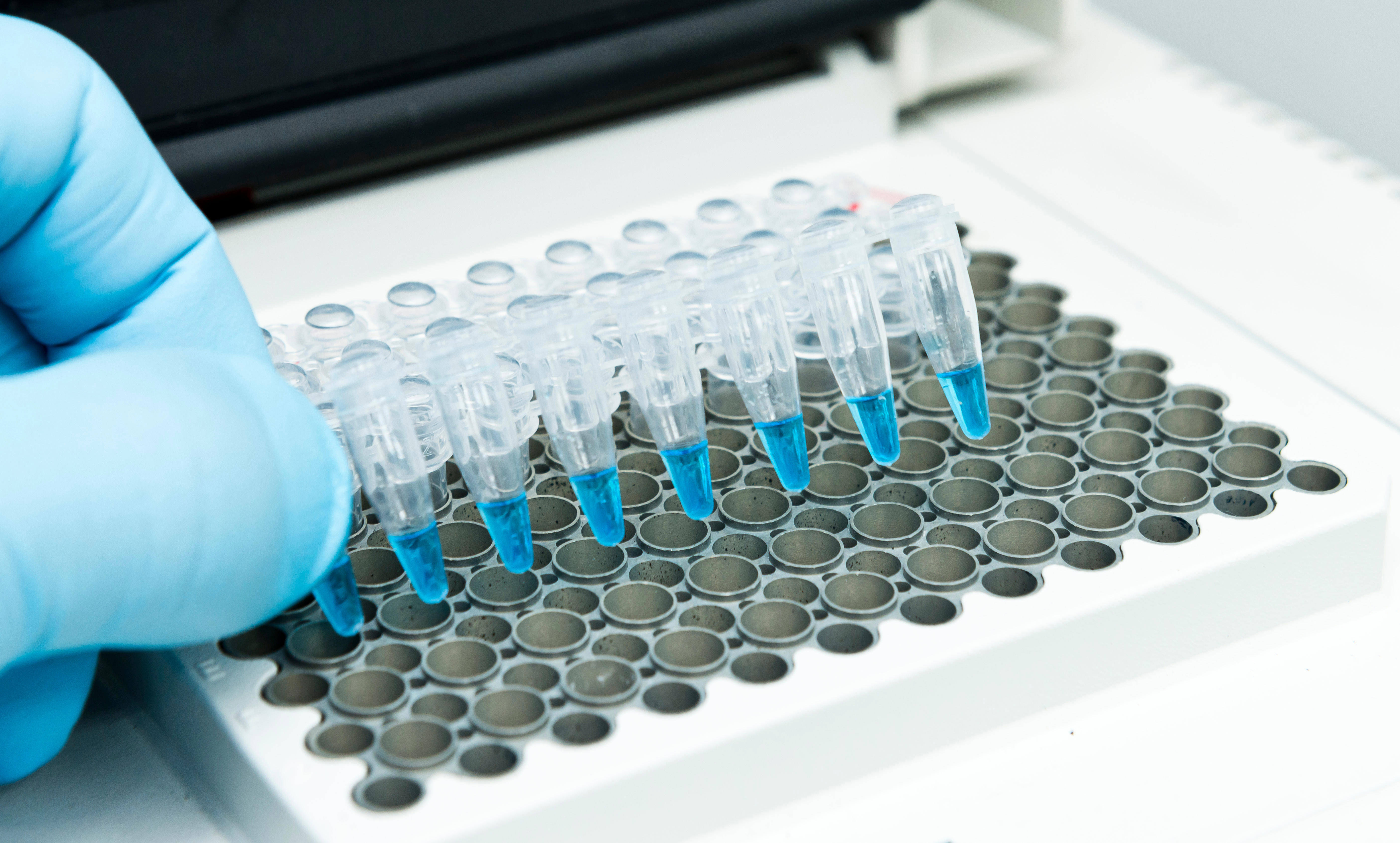a-researcher-put-a-strip-of-8-pcr-tubes-on-the-thermal-cycler-for-dna-amplification_adobestock_297083244
